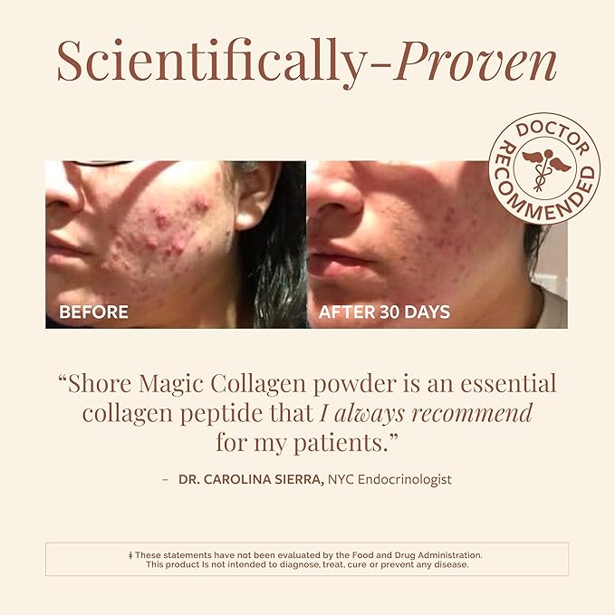 Shore Magic Premium Marine Collagen Powder – Hydrolyzed Type I, II, III & IV Peptides from Wild Fish for Skin, Hair, Nails & Joints, 14 Servings