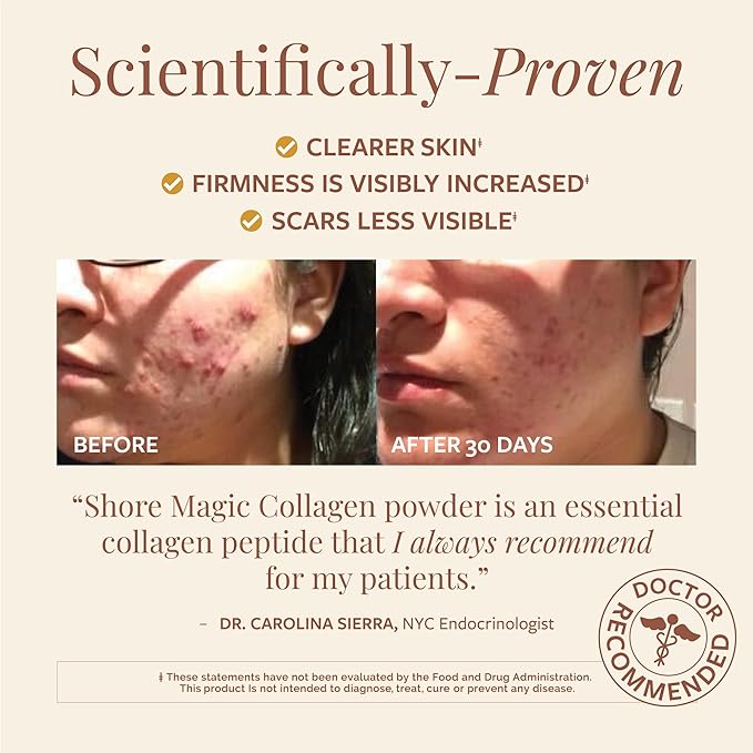 Shore Magic Premium Marine Collagen Powder – Hydrolyzed Type I, II, III & IV Peptides for Skin, Hair, Nails & Joints – Wild-Caught Fish, Kosher, Unflavored, Travel Friendly, 28 Daily Packets