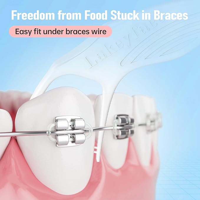200 Count Twin-Line Braces Flossers, Orthodontic Flossers for Braces, Fits Under Arch Wire No Damage, Whale Wider Handle with Unique Finger Press, Ortho Dental Floss for Kids & Adults, Mint